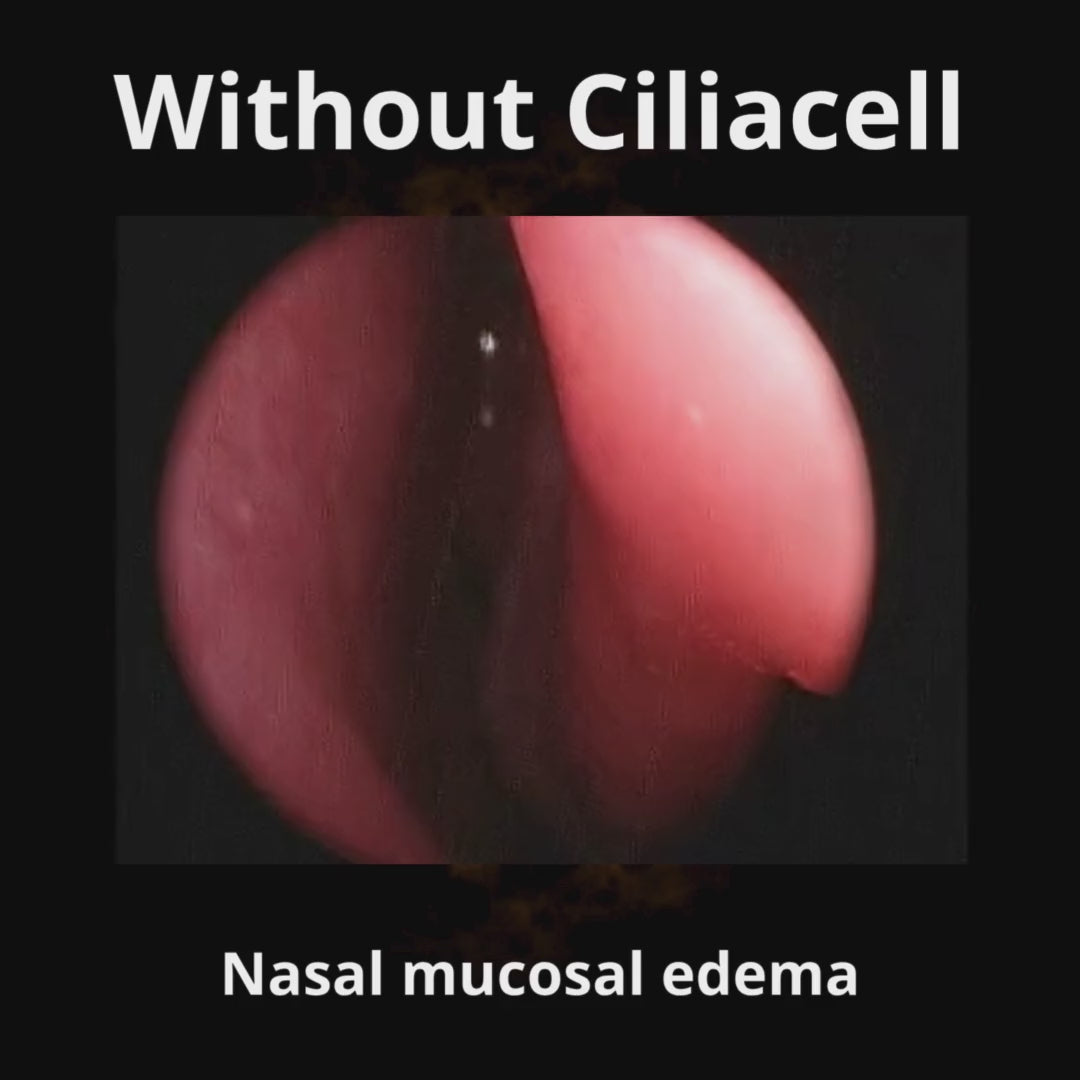 Load video: CiliaCell Nasal Spray - Adult SENSITIVE