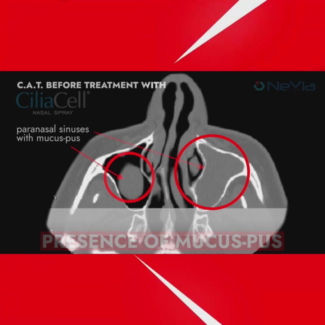 Load video: CiliaCell Nasal Spray - Adult SENSITIVE